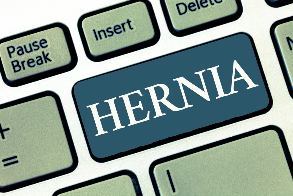 Bard Hernia Mesh Lawsuit Results In Positive Jury Verdict Law Office